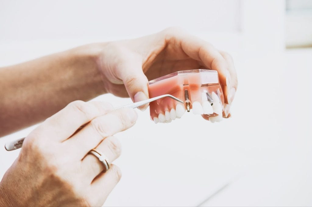 Precise Tooth Replacement With Dental Implants in Cary, NC